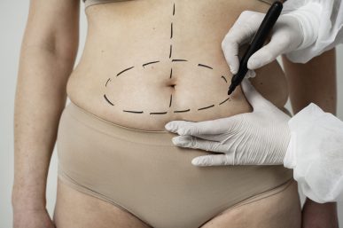mujer-de-vista-frontal-con-rastros-de-marcador-en-el-vientre